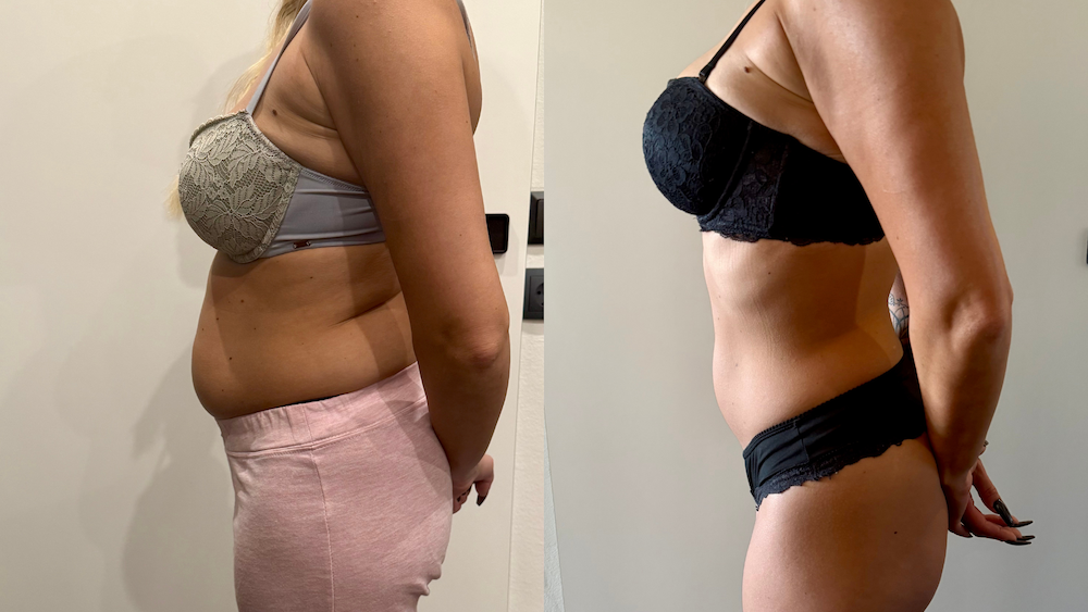 Johanna Transformation